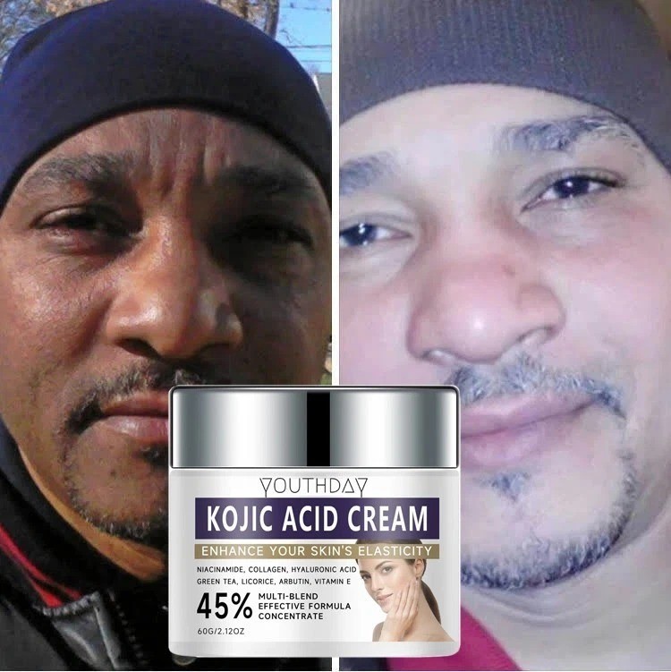 White Fade Super Skin Lightener Cream For Dark Skin Strong Kojic Acid Cream 2oz