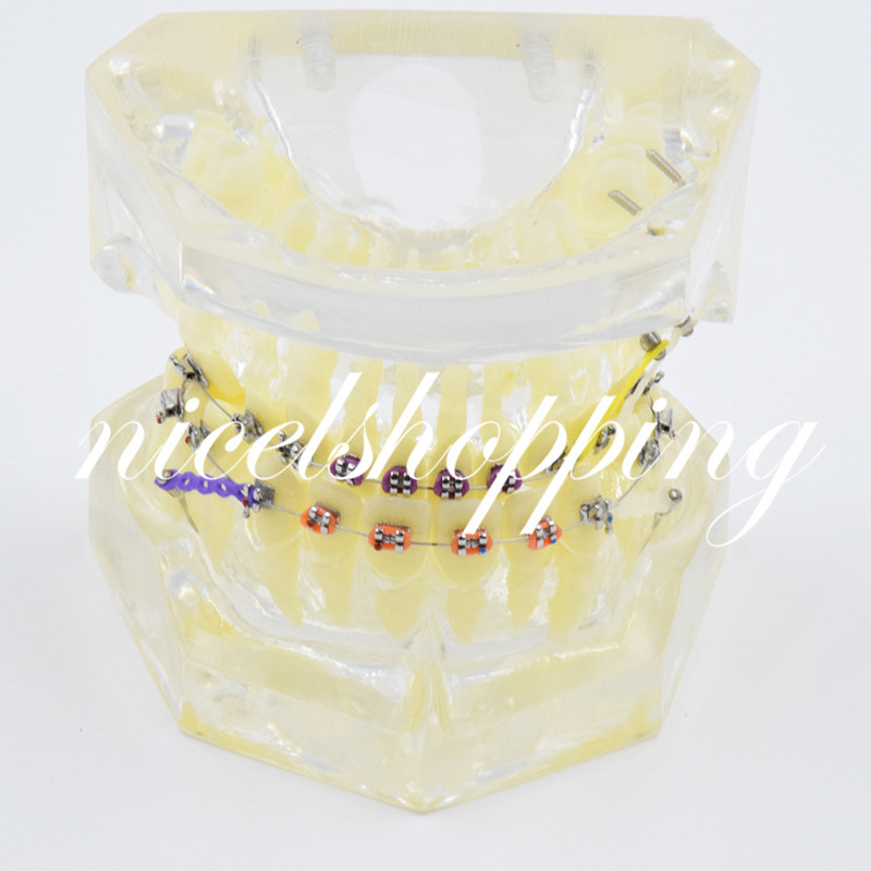 1X 3005-2 Dental Orthodontics Transparent Treatment Teeth Model Teach Model New