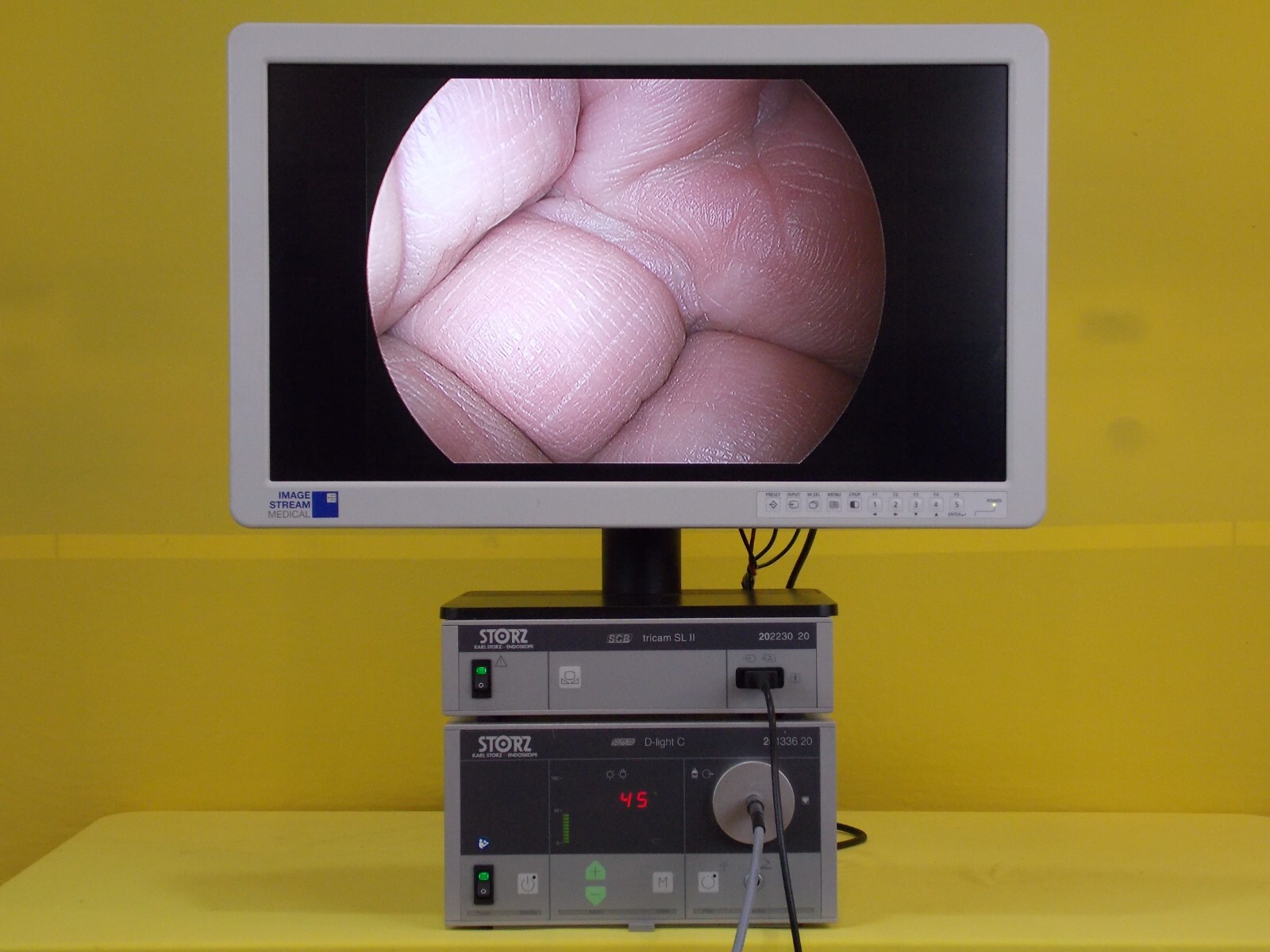 Storz PDD CYSTOSCOPY Tricam 20223020/20133620/20221139/495FS/ISM 26"HD Monitor