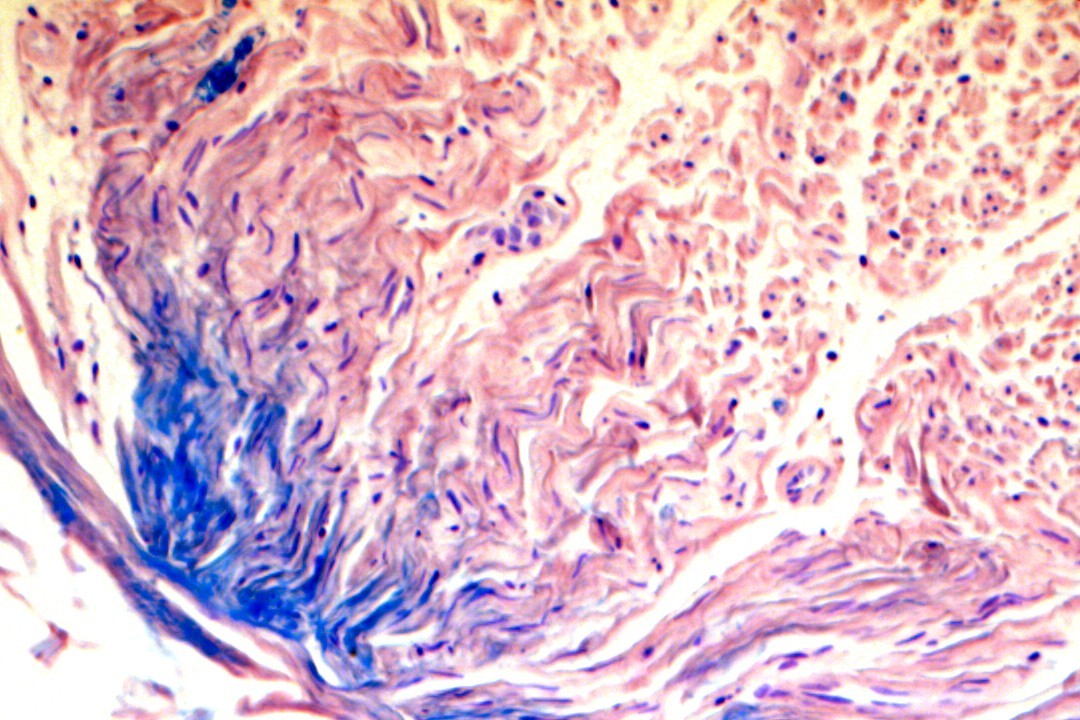 VitroView™ Luxol Fast Blue Stain Kit (Cat# VB-3006)