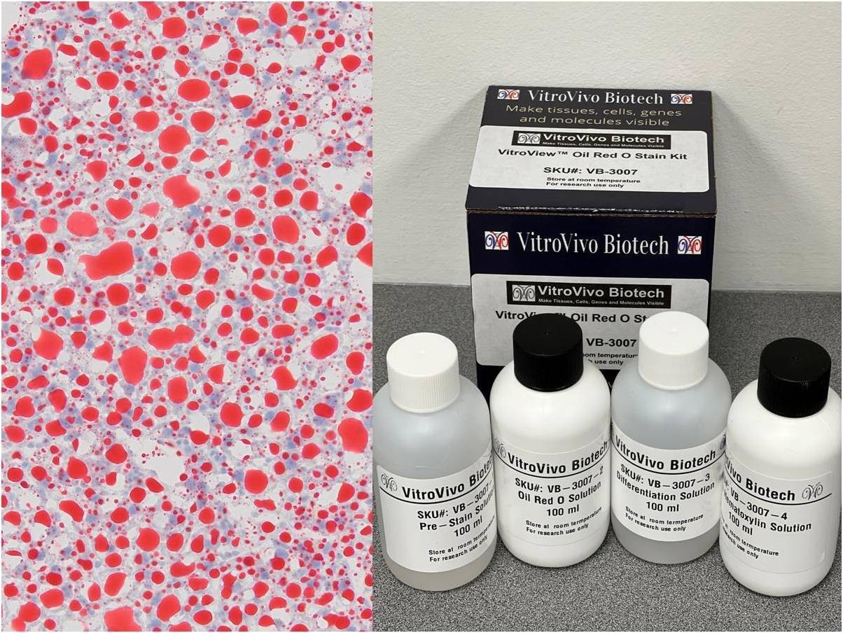 VitroView™ Oil Red O Stain Kit (Cat# VB-3007)