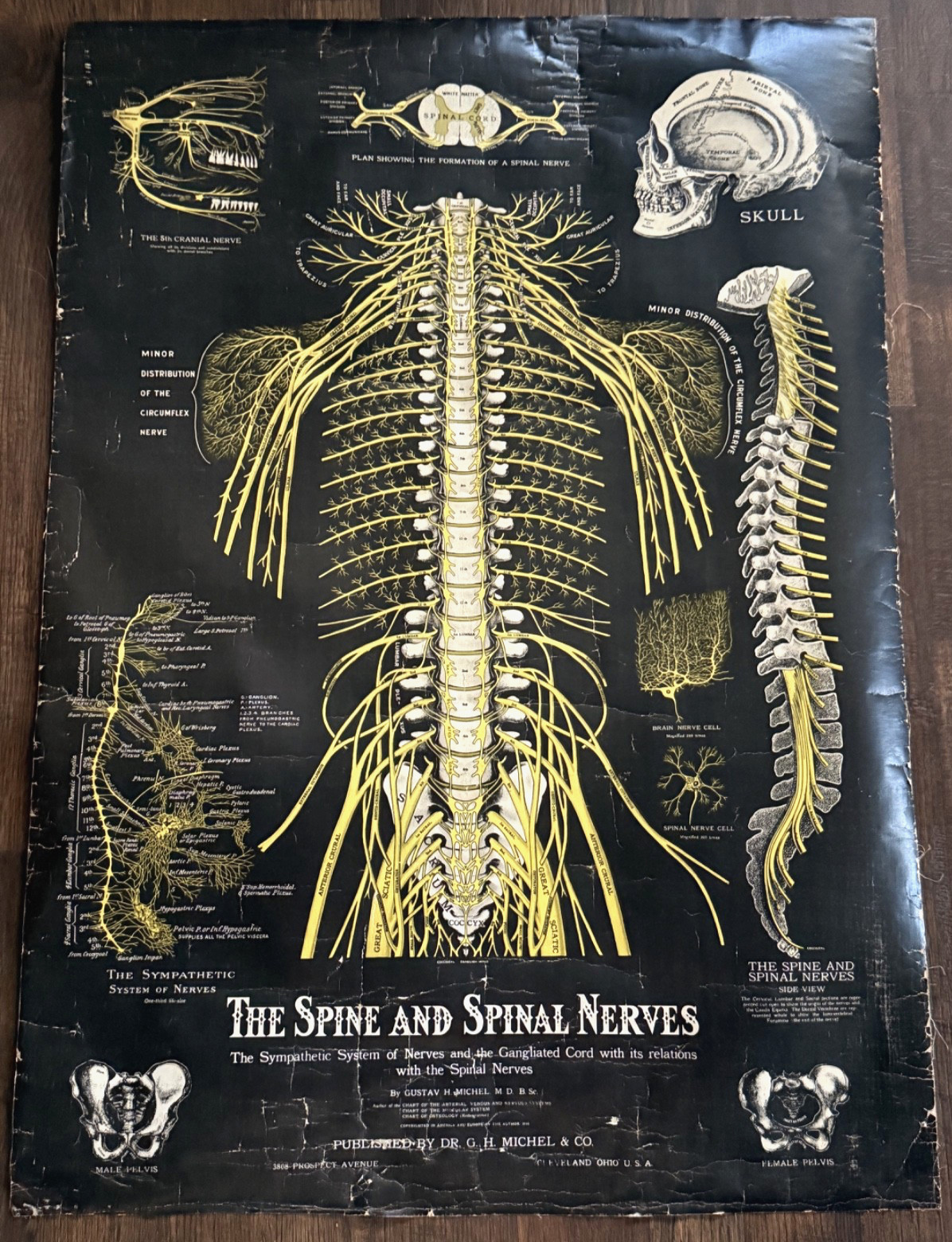 Antique Spine and Nerve Chart Poster Dr. G.H. Michel & Co. Early 1900's Medical!