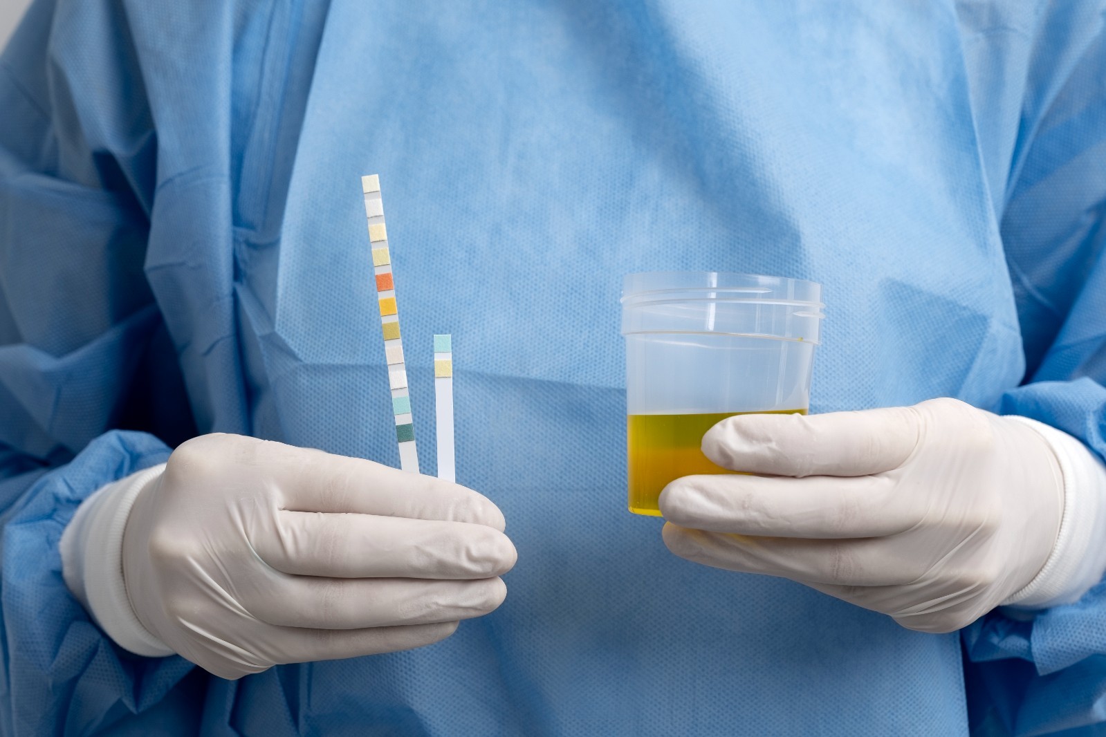 synthetic calibration fluid