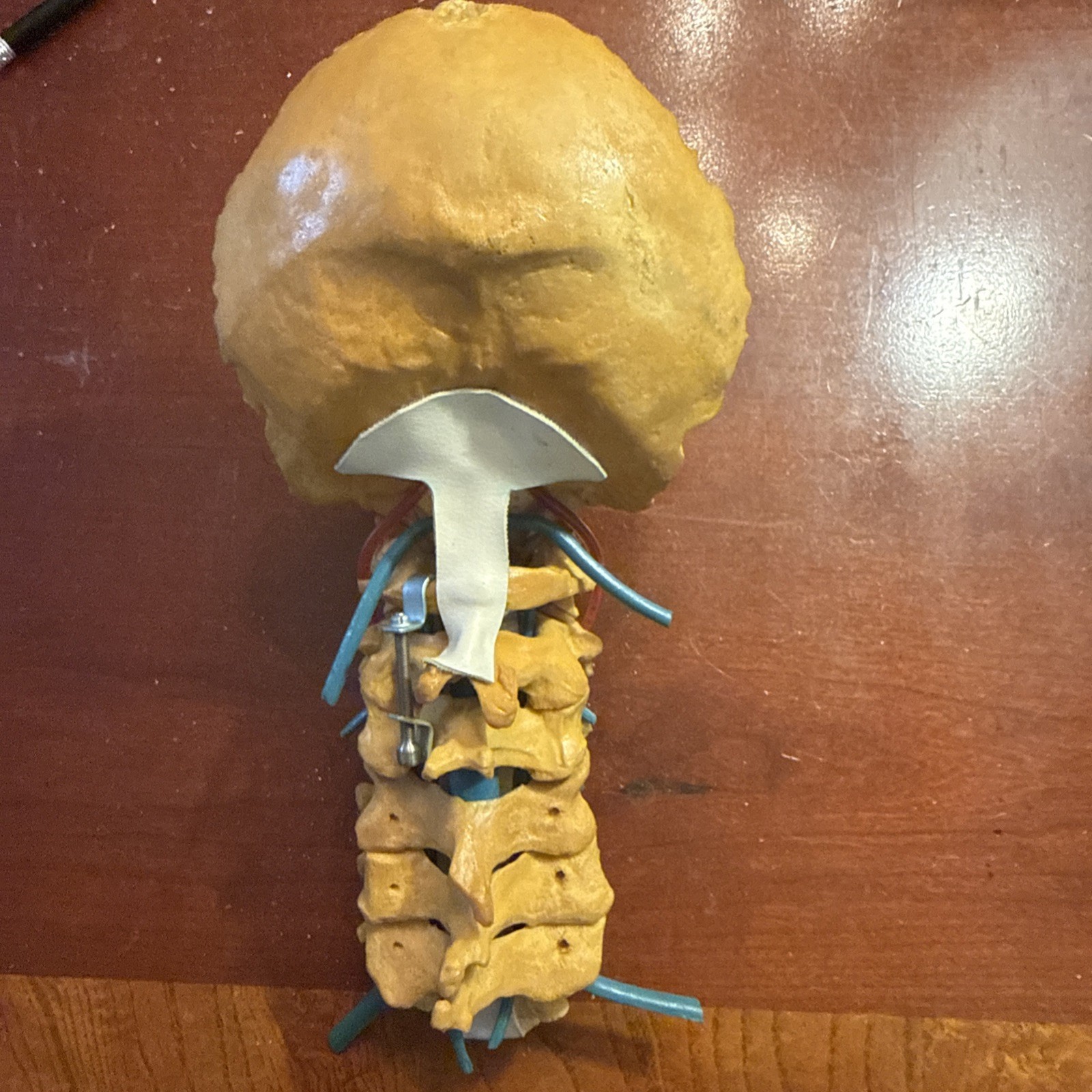 Cervical Spine Model With Fixation