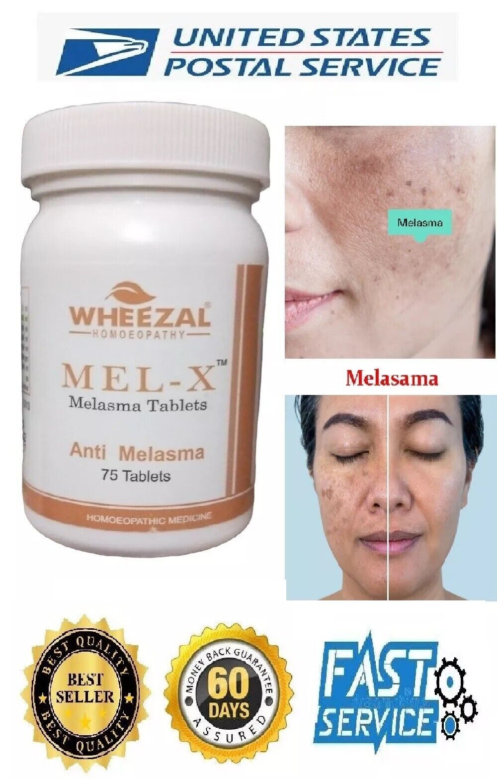 Wheezal Homoepathy Mel-X (75 Tablets) for Pigmentation , 100% Homeopathy Formula