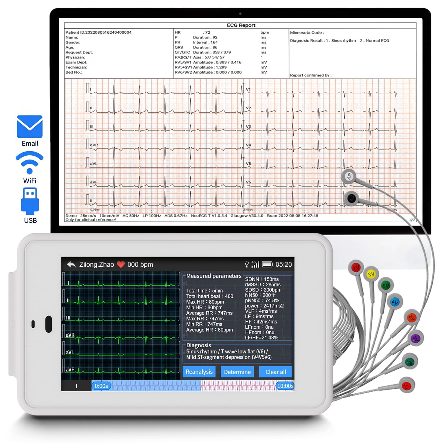 Portable 6/12 Lead ECG Machine Email Data Transferfor Home/Clinic/Emergency Use
