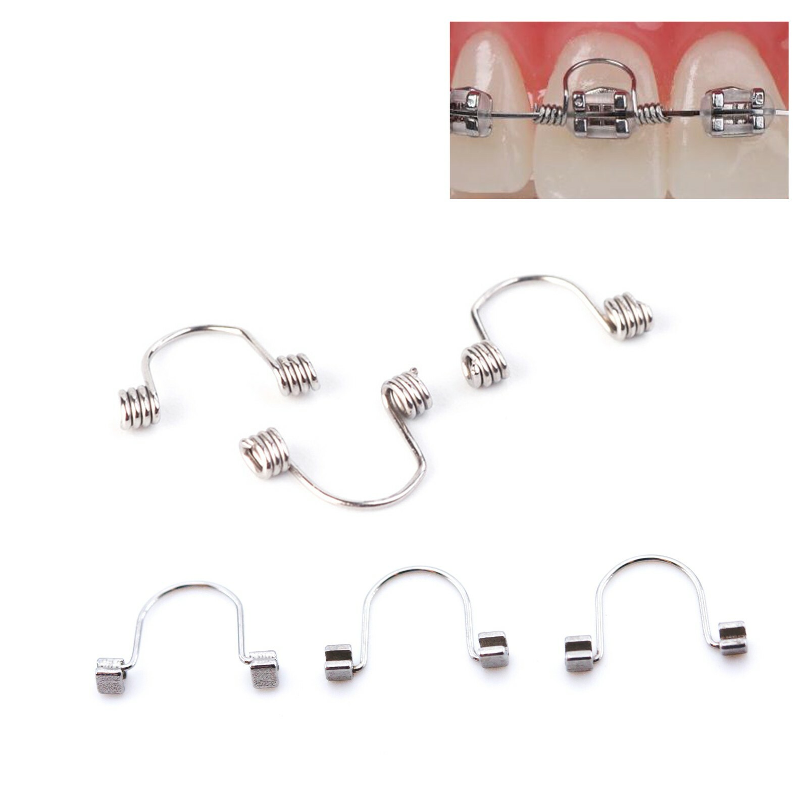 J&J Ortho™ Dental Orthodontic Archway Torquing Arch Spring (10/pk)