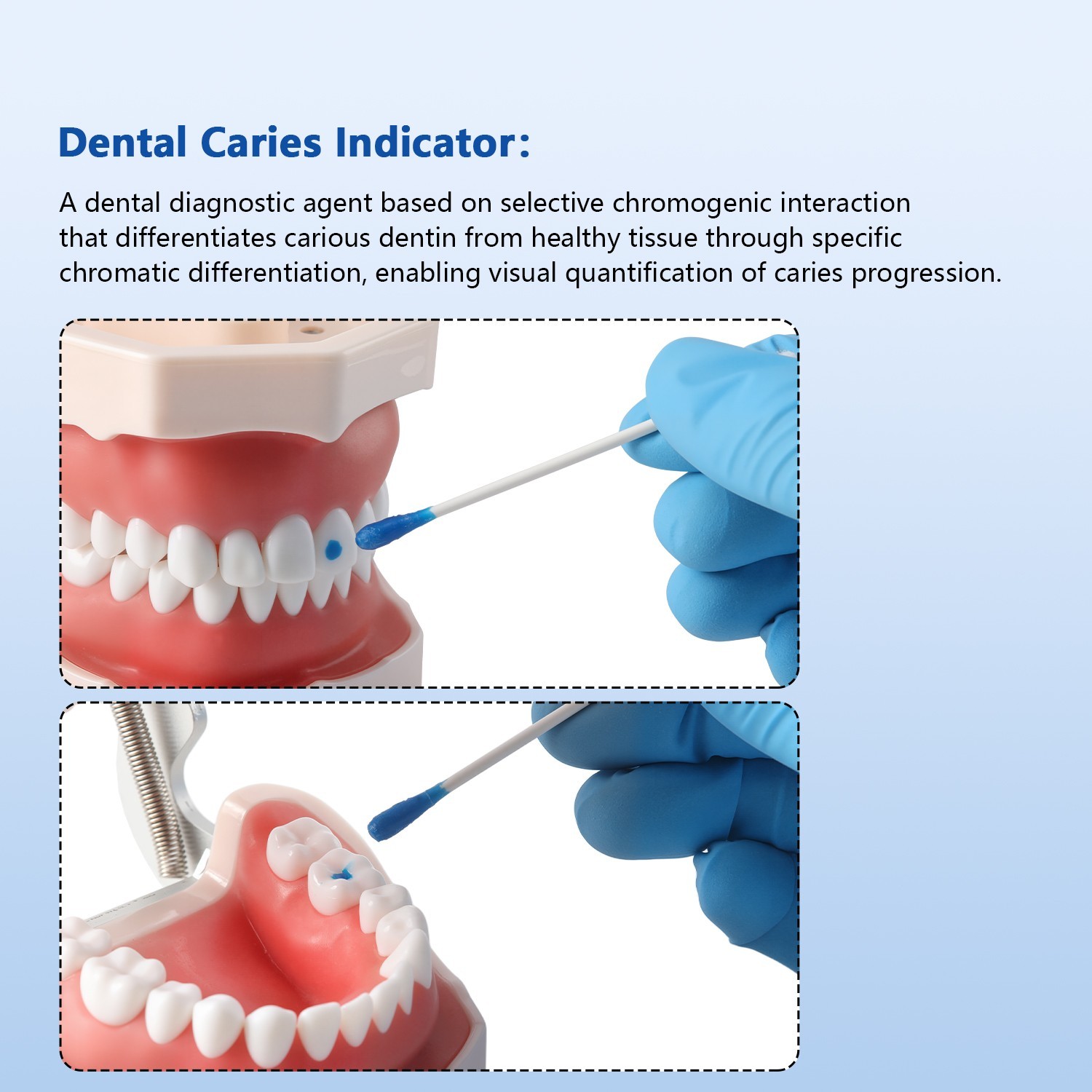 5ml Pack Caries Indicator Dye Dentin Caries Detector Locating Root Canal Orifice
