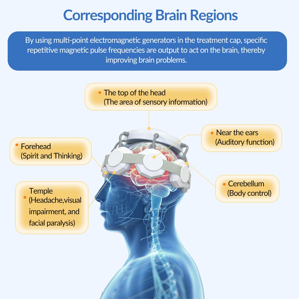rTMS Therapy Transcranial Magnetic Stimulation Therapy TMS for Depression-