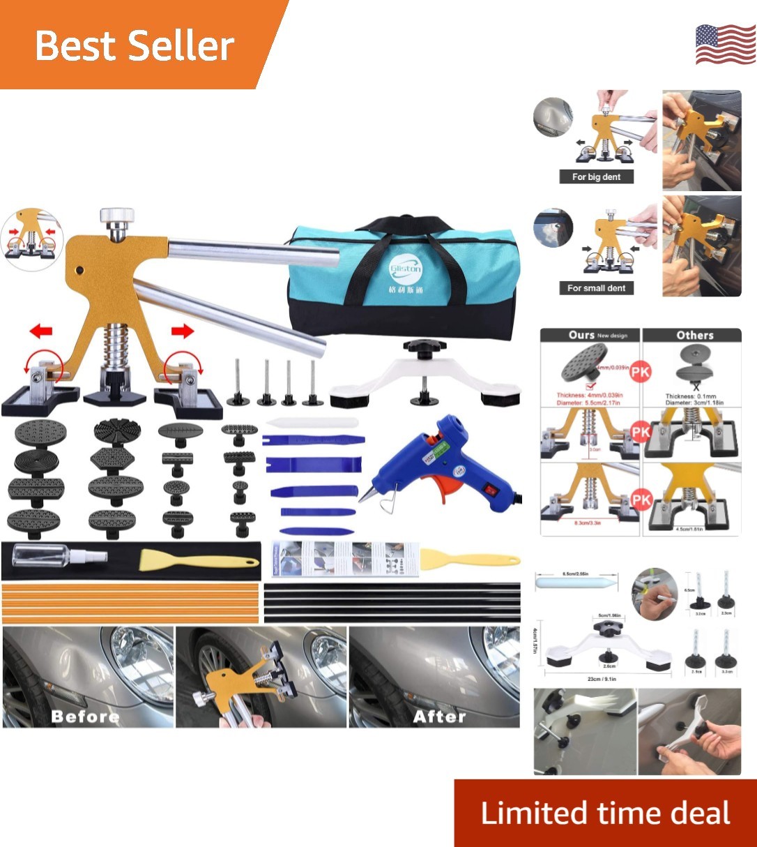 Quick & Easy 45pcs Paintless Dent Repair Set with Glue Gun - Car & Appliance