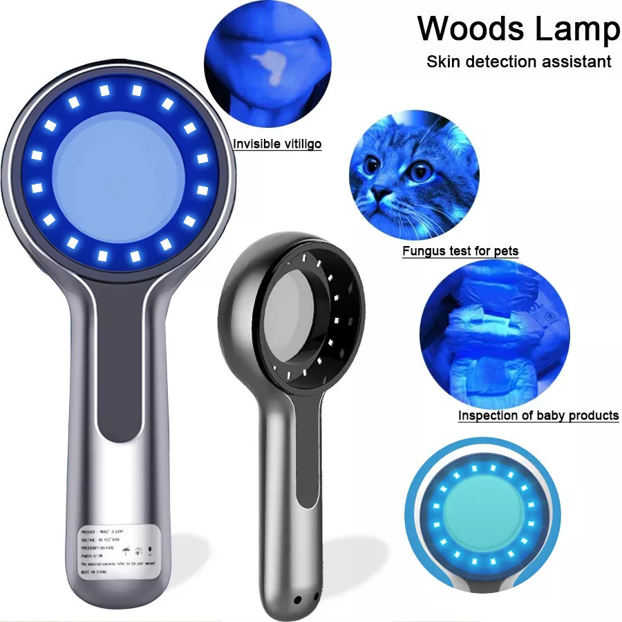 Woods Lamp Skin Analyzer for Skin Fungal Infection & Home Environmental Testing