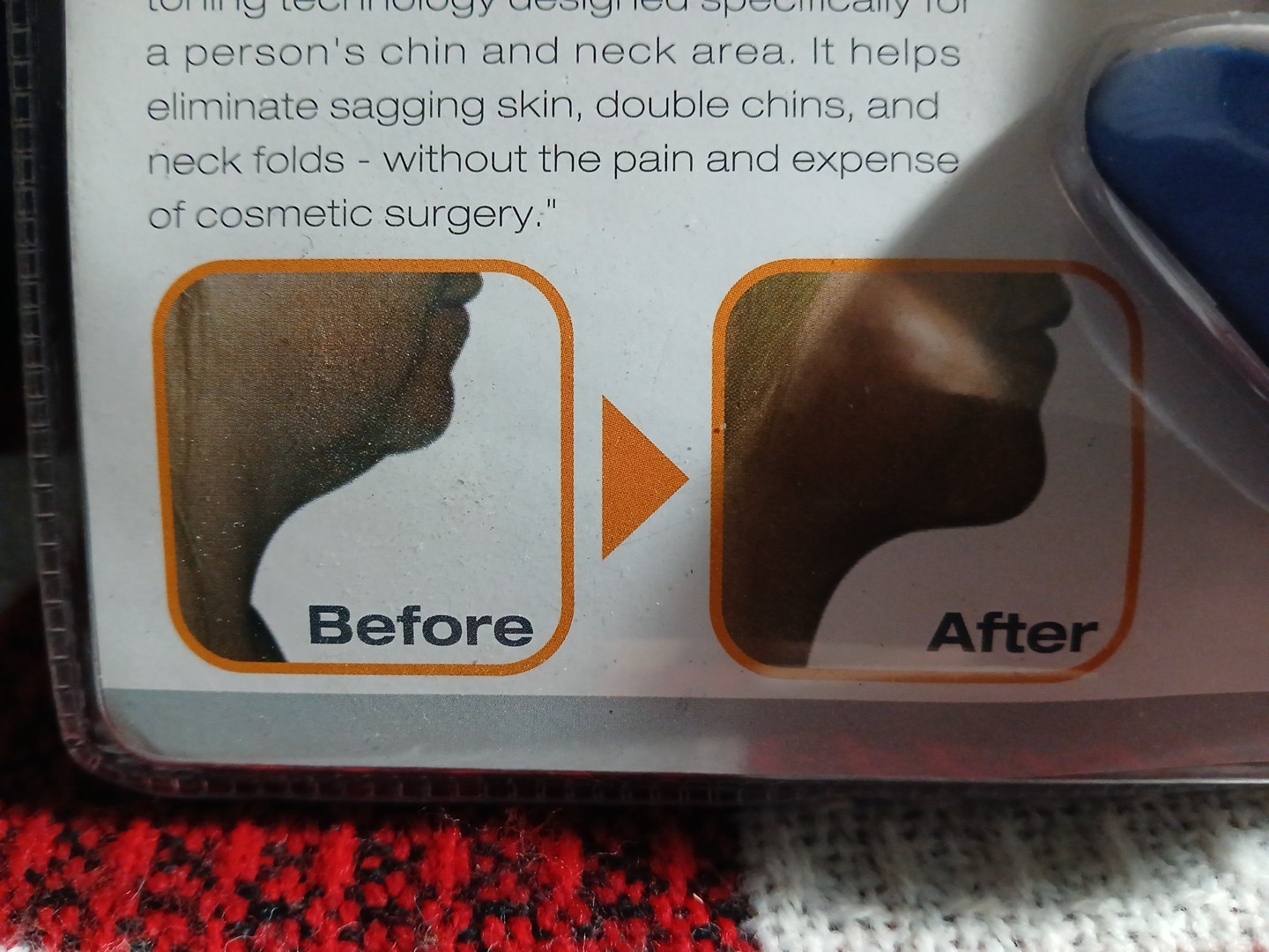 Total Vision Neck Toner