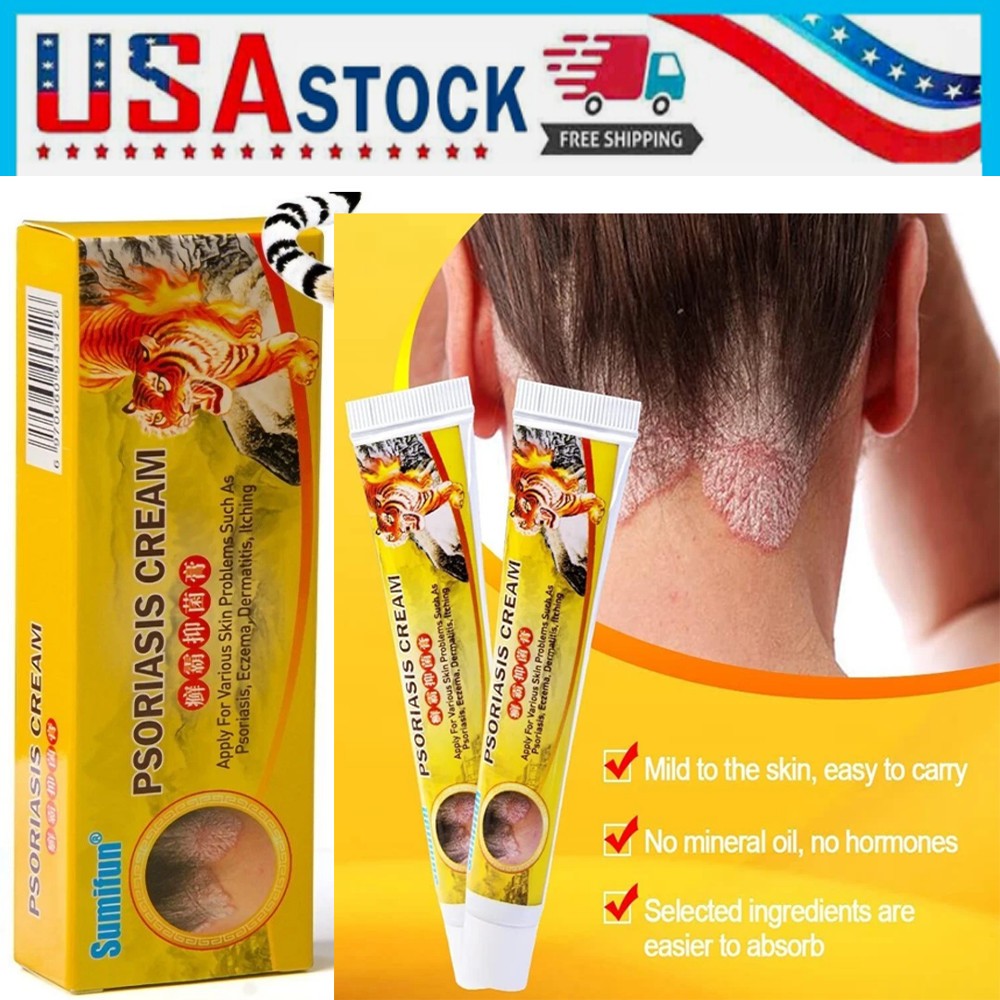 Health Care Psoriasis Cream Eczema Ointment Scalp Psoriasis Hand Tinea Foot 15g