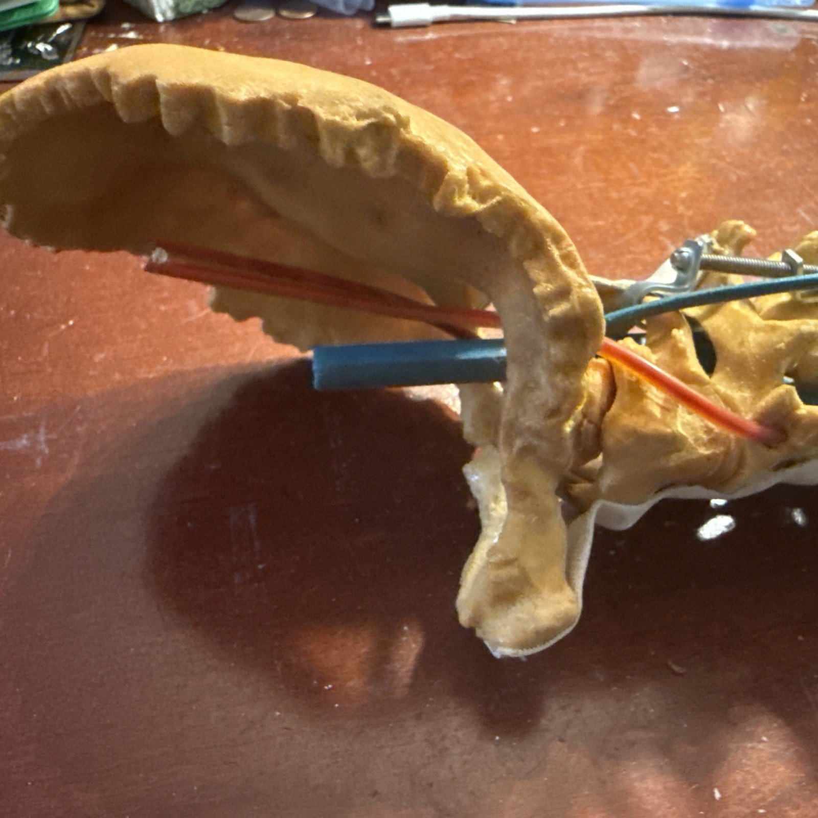 Cervical Spine Model With Fixation