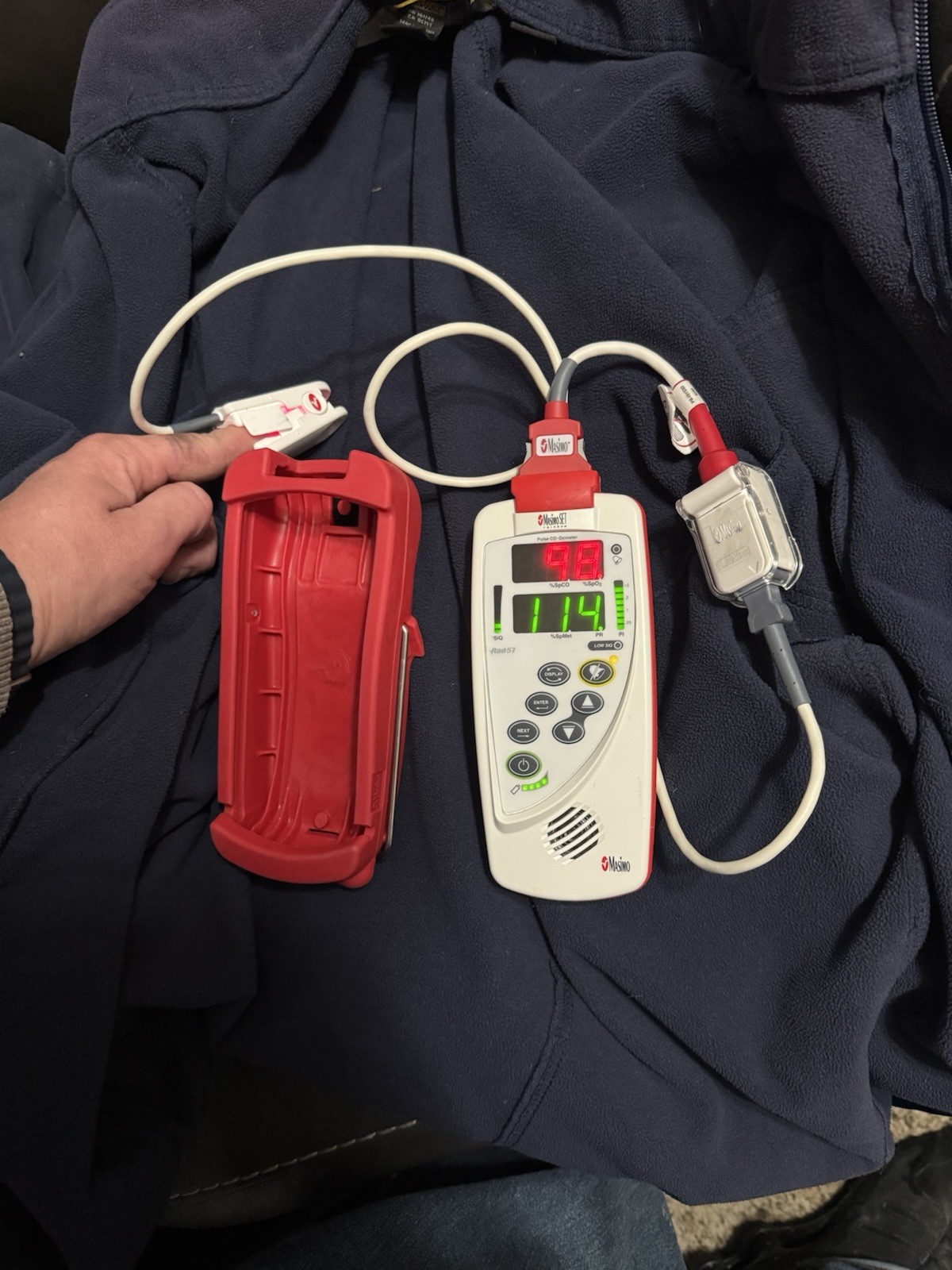 Masimo Rad-57 Pulse CO-Oximeter