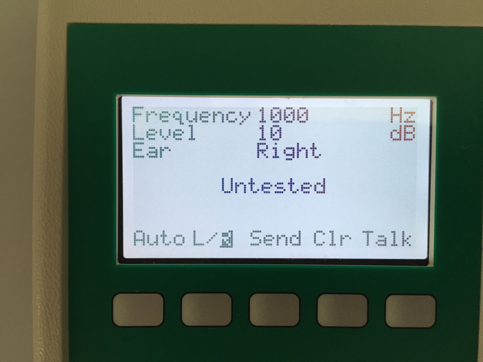 Micro Audiometers Earscan 3 Screening Audiometer (ES3S)