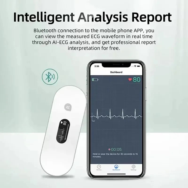 Portable ECG Monitor Unlimited Data Storage Share Wearable Electrocardiograma