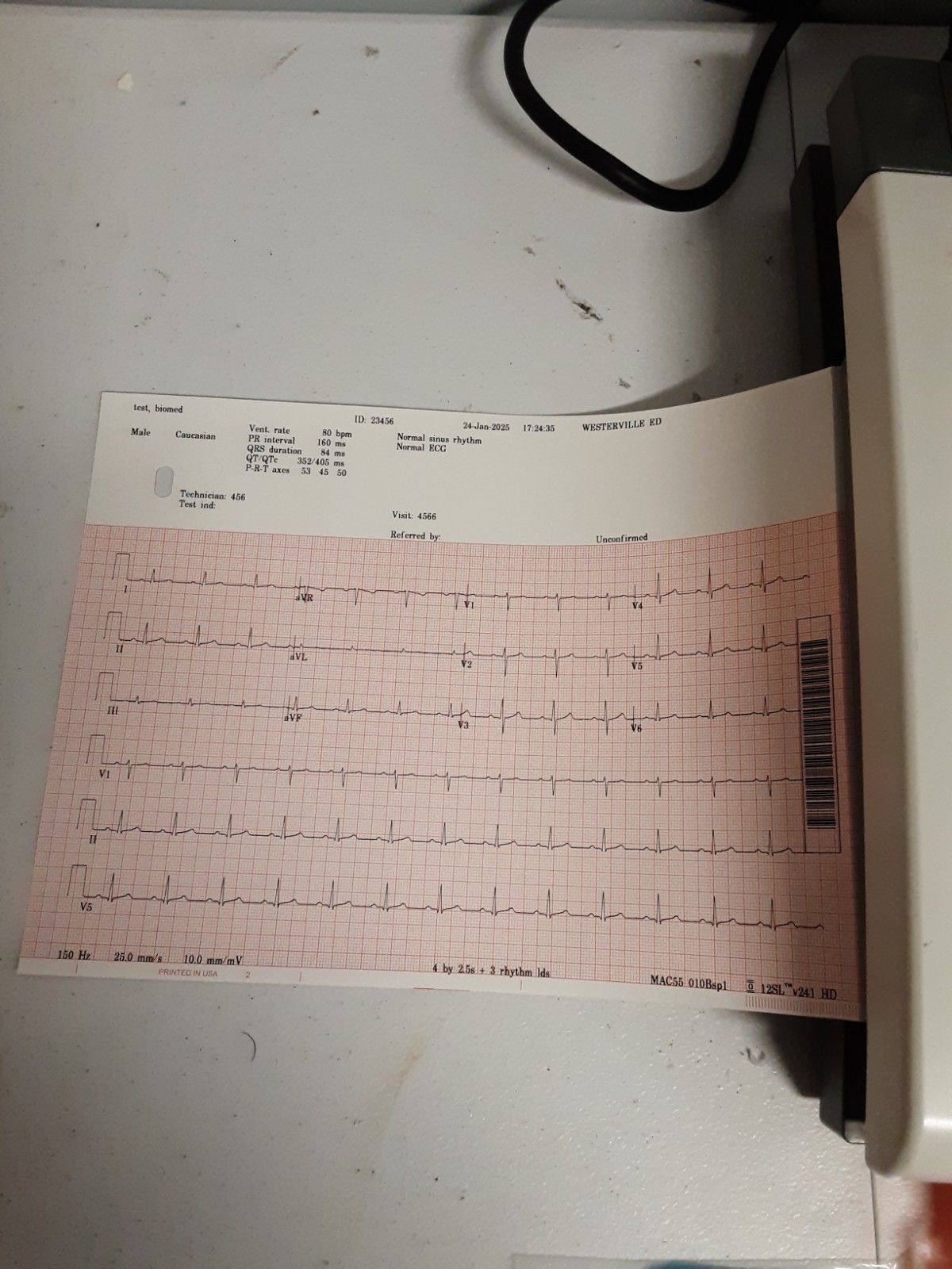 GE MAC 5500 HD EKG , with all accessories 60 day free waranty and retun incl