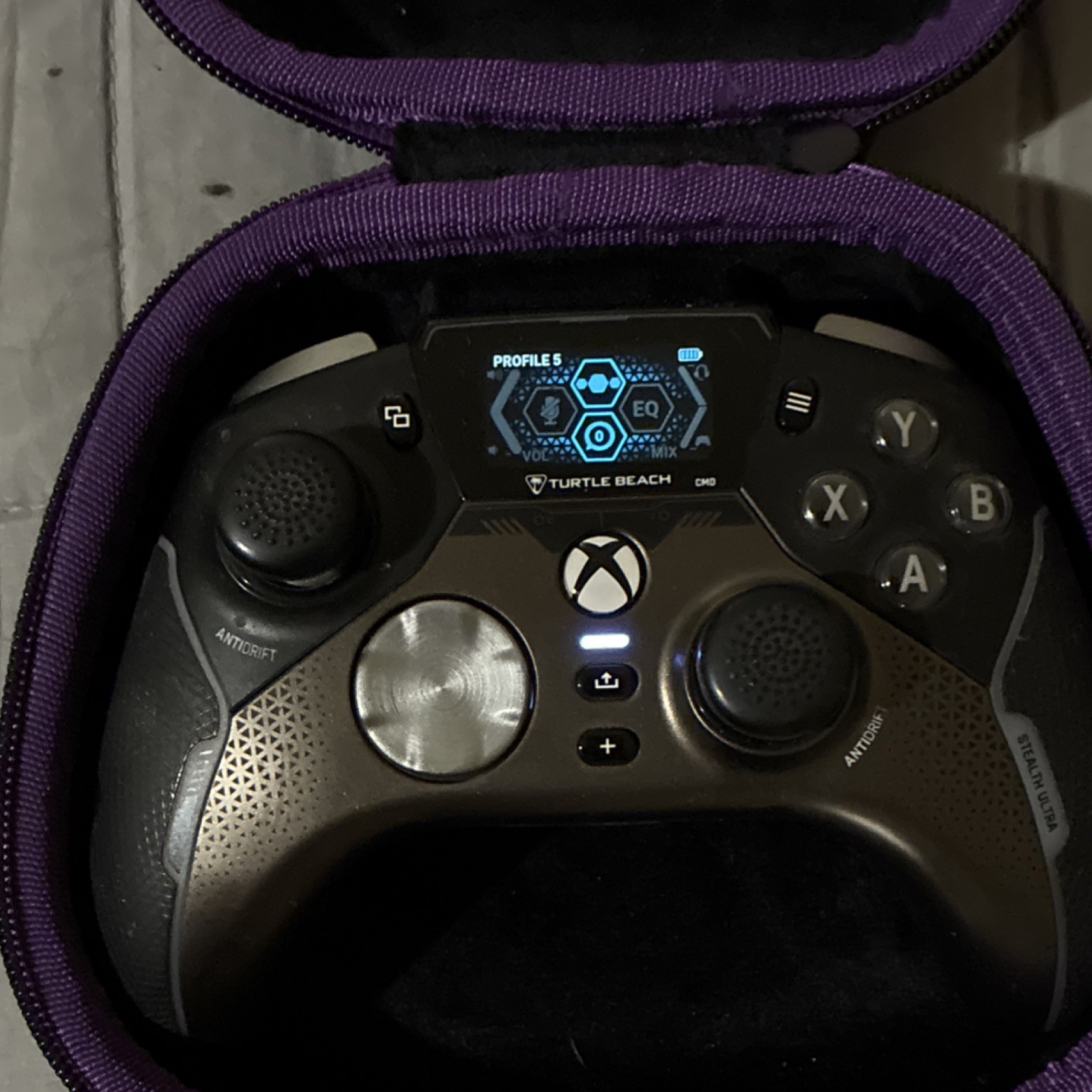 Turtle Beach Stealth Ultra Controller Bundle with Case, Dock, USB Adapter