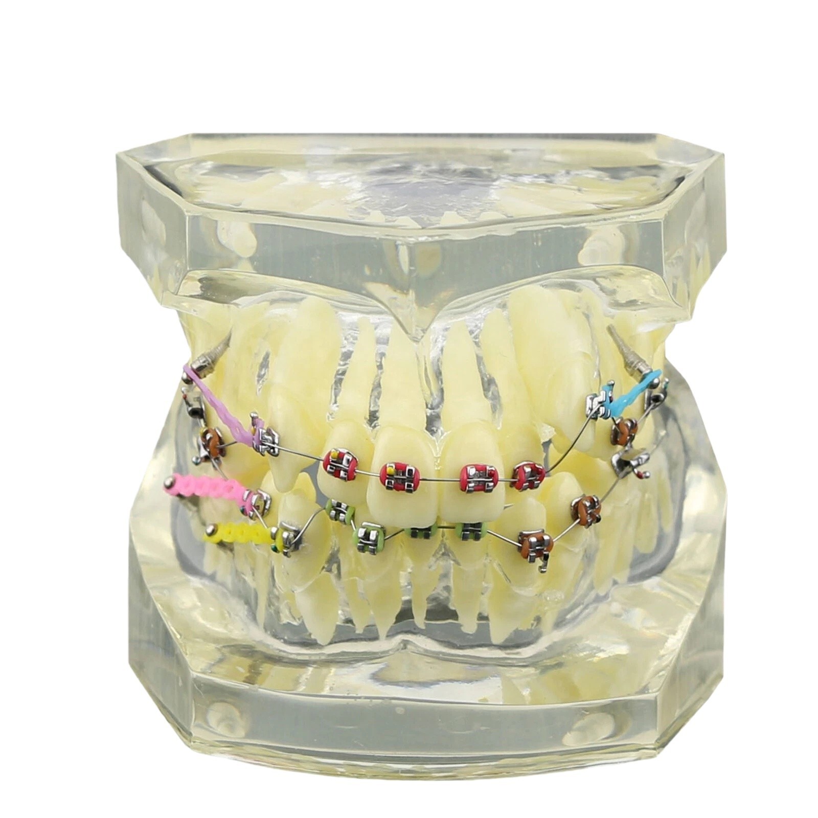 Dental Ortho Orthodontic Study Teach Model with Brackets Wires Ties Chains