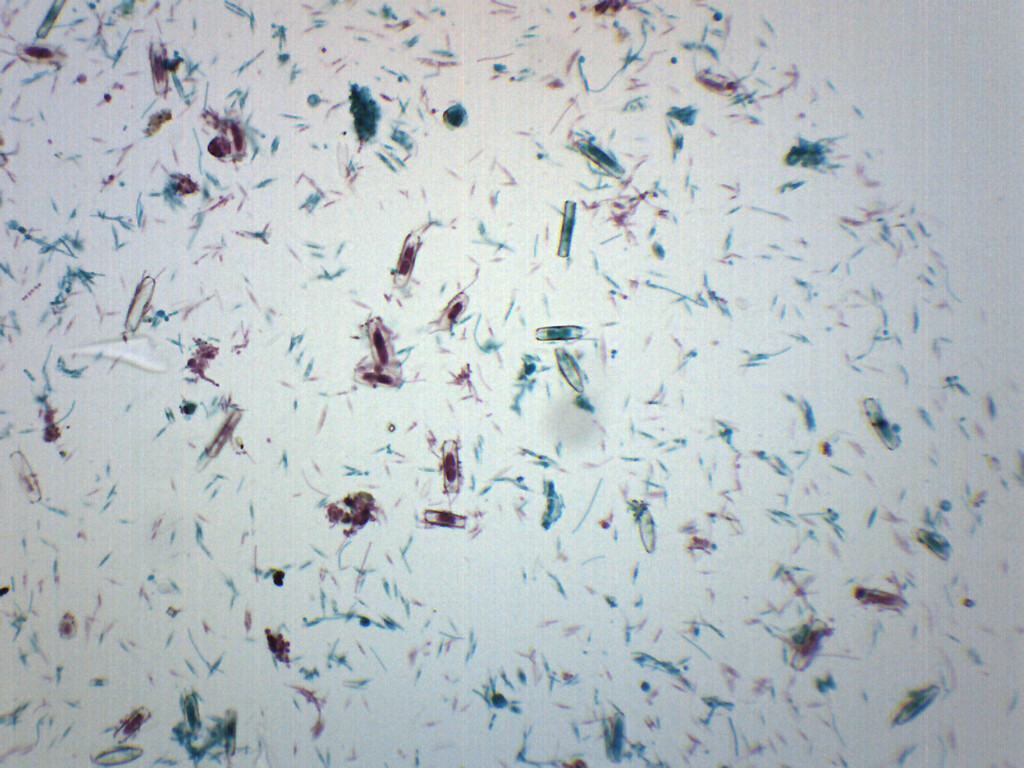 Fungi-Mixed Diatoms - WM - Prepared Slide - 75x25mm - Eisco Labs