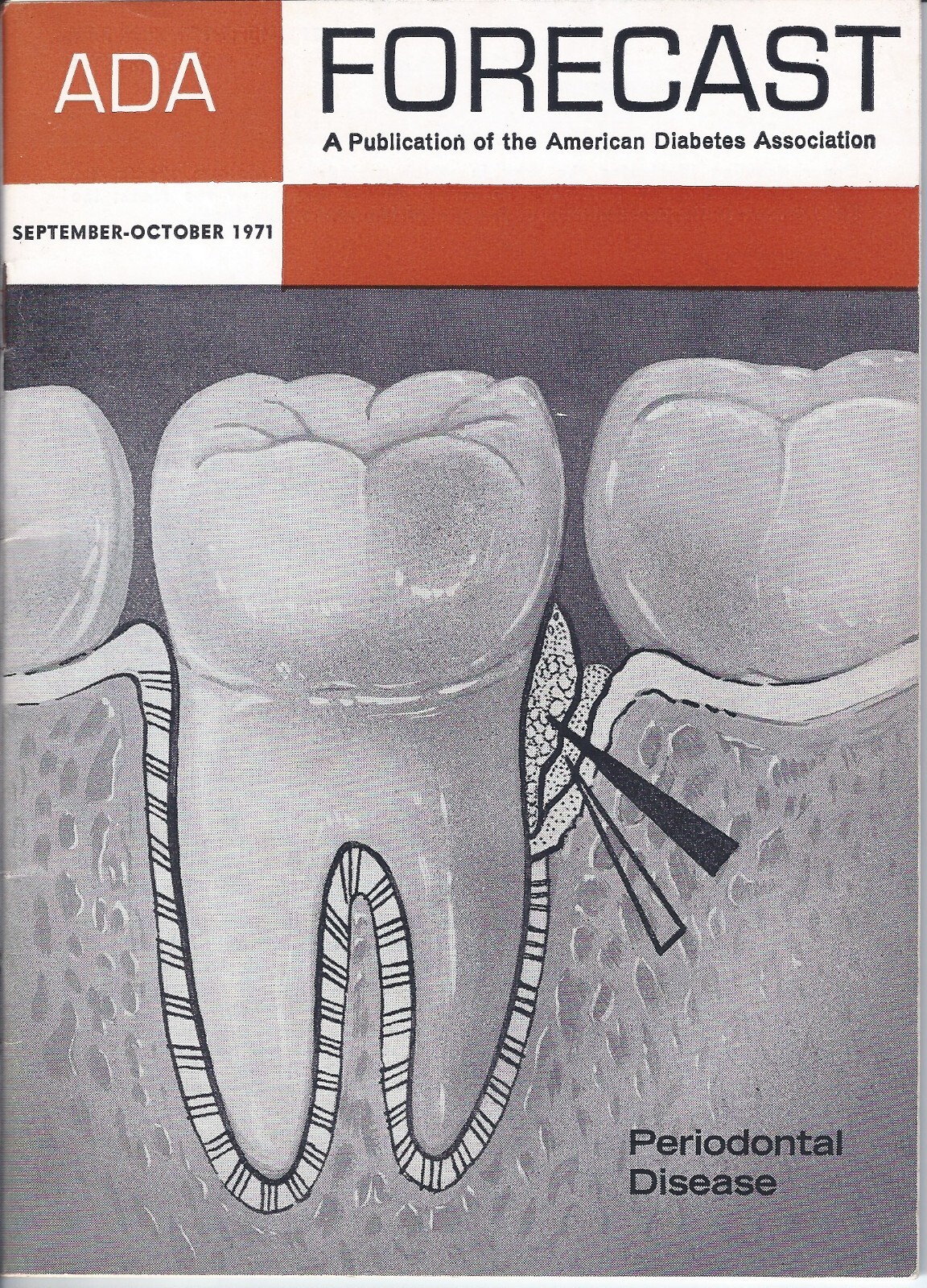 ADA Forecast September-October 1971 American Diabetes Association Publication