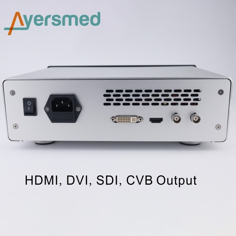 Full HD Endoscopy Camera for ENT Rigid Endoscope With Record Function