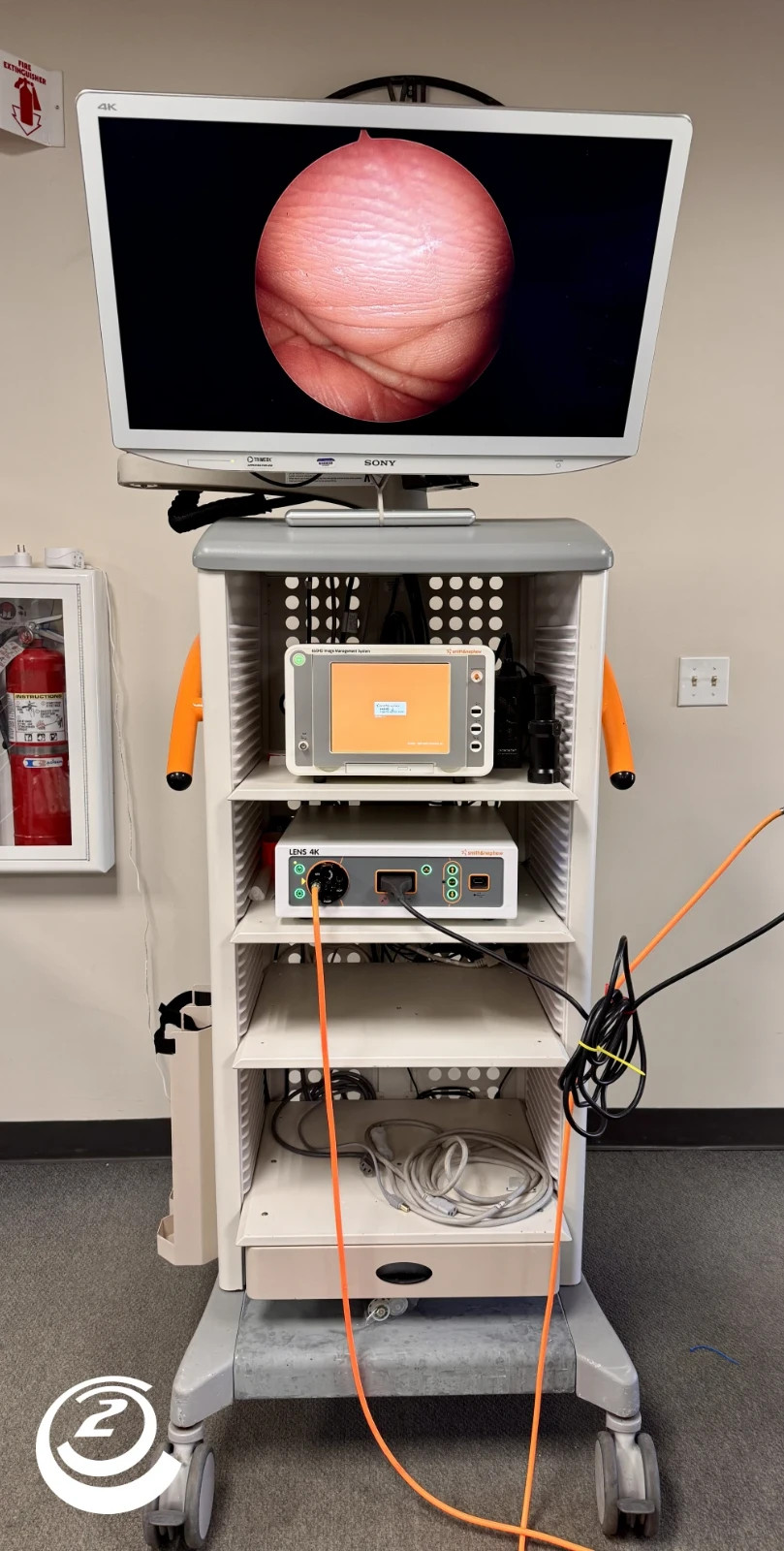 Smith & Nephew LENS 4K Endoscopy system