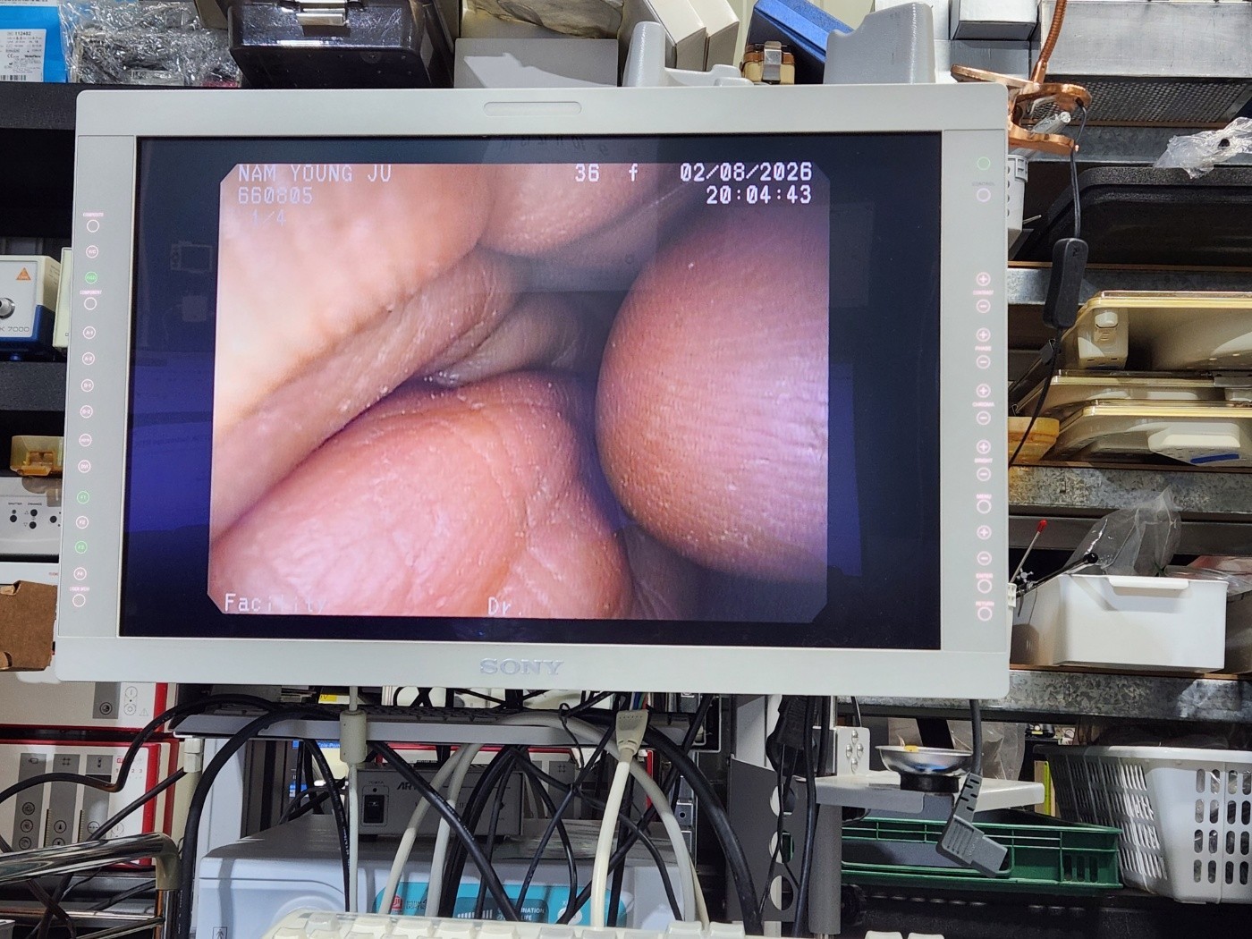 Pentax EG-290KP Gastroscope NTSC