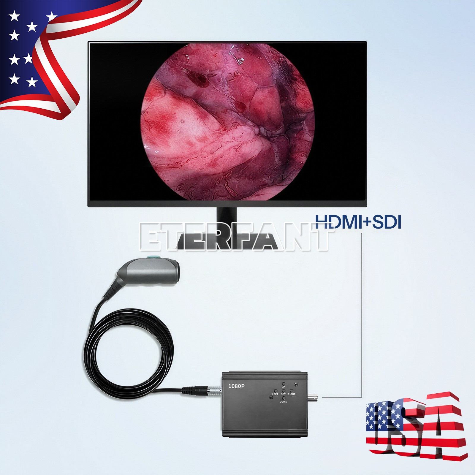 Endoscopy Camera Full Hd 1080p Laparoscopic Endoscope System for Laparoscopy