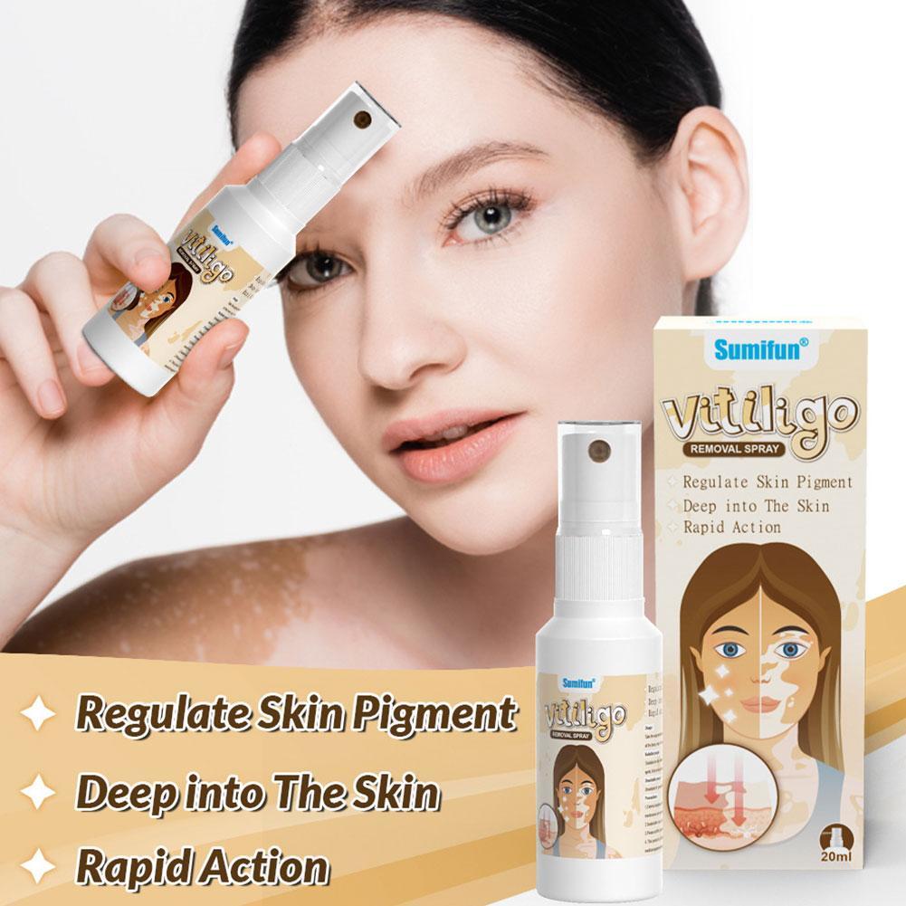 -..Vitiligo Removal Cream Natural White Spot Treatment Leucoplakia Acting Fast M