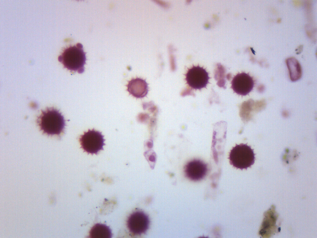Dicot Pollens - Prepared Microscope Slide - 75x25mm - Eisco Labs