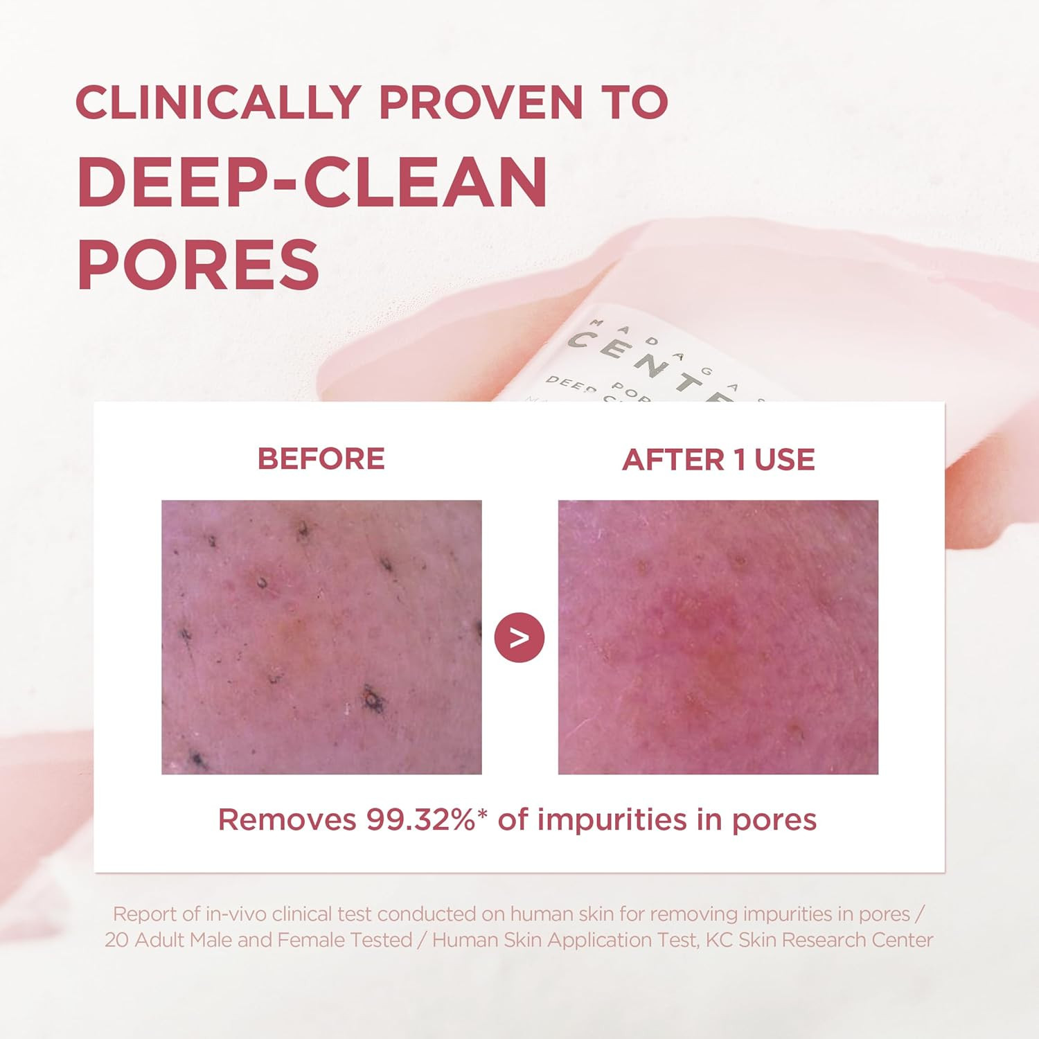 Poremizing Deep Cleansing Foam, 4.23 Fl.Oz, 125Ml, Makeup Remover, Korean Face C