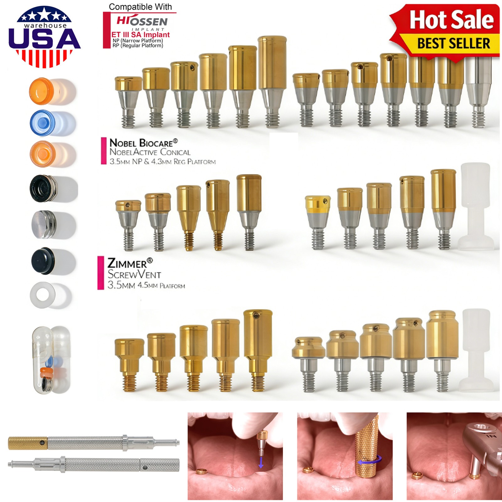 US Overdenture Fit Zest Locator Ti Abutment Retention Caps Hiossen Nobel Zimmer