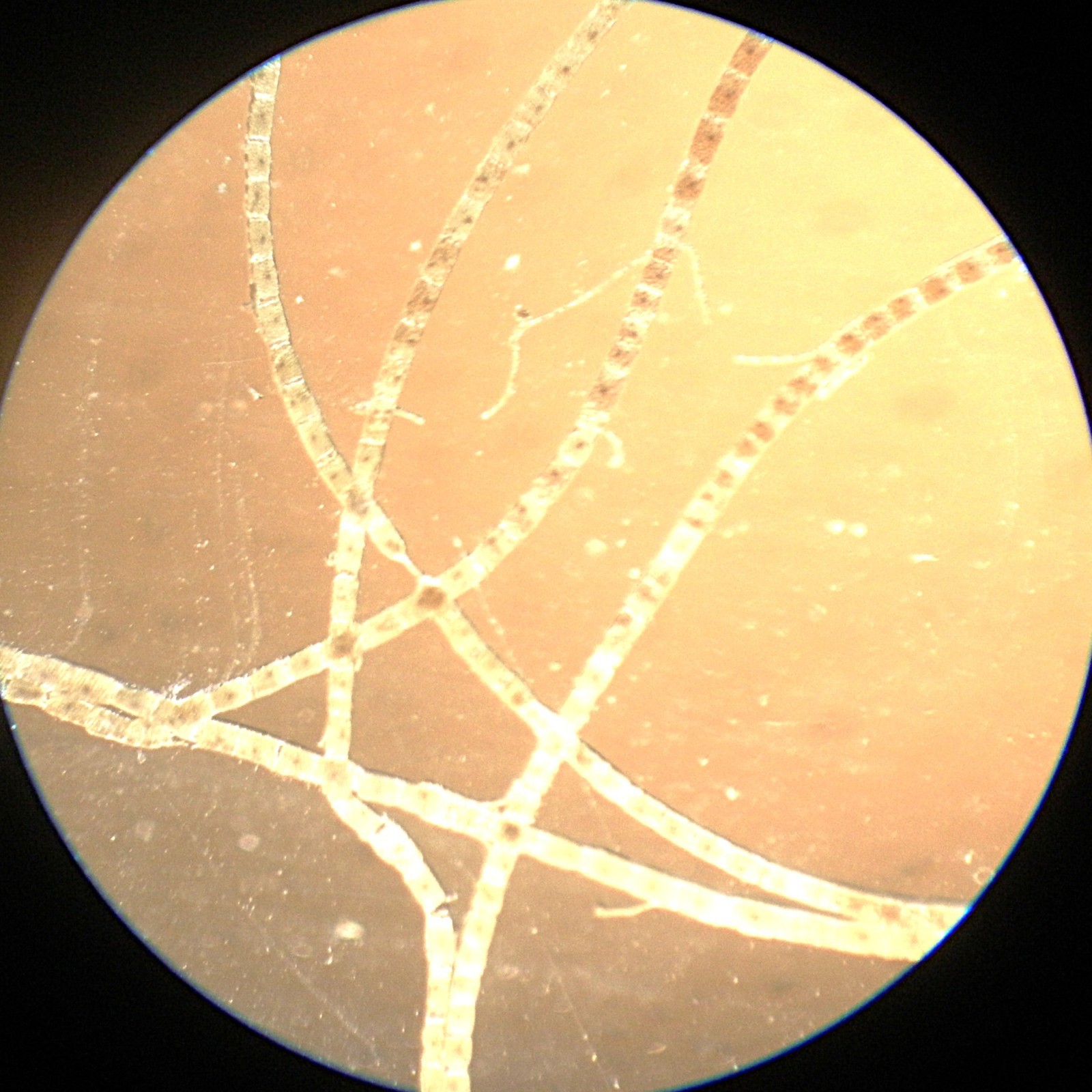 3 Antique Microscope Slides. Freshwater Algaes.