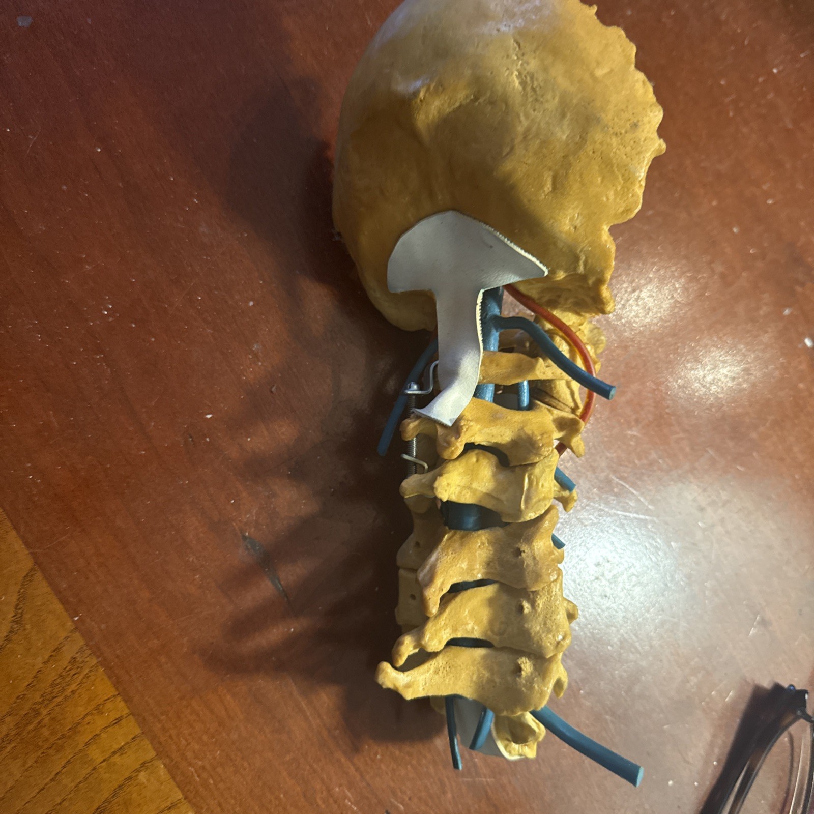 Cervical Spine Model With Fixation