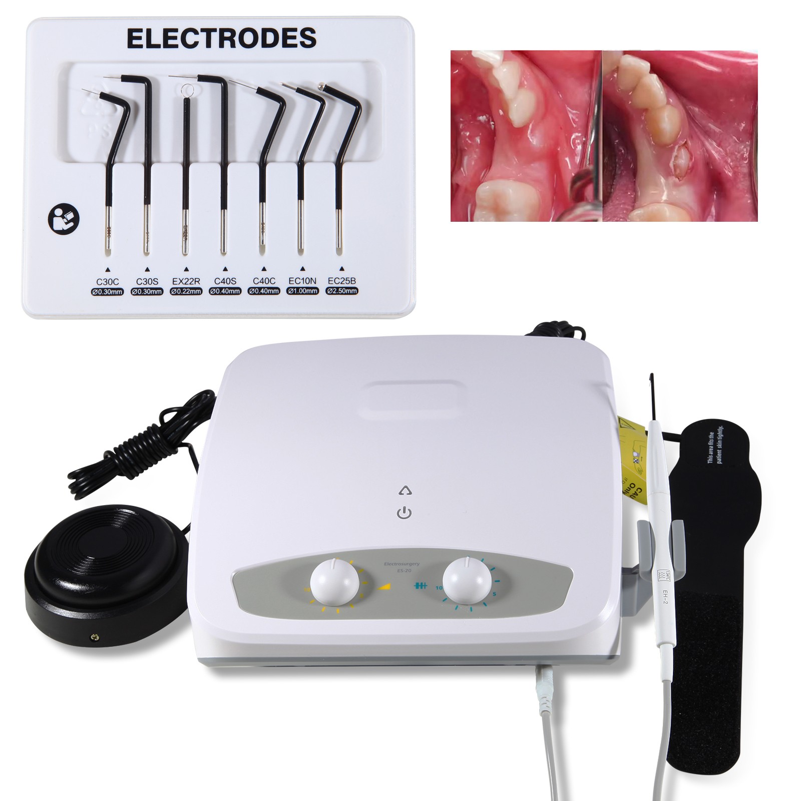 Electrosurgery Unit Dental Electro System High Frequency 7PCS Electrode Tips