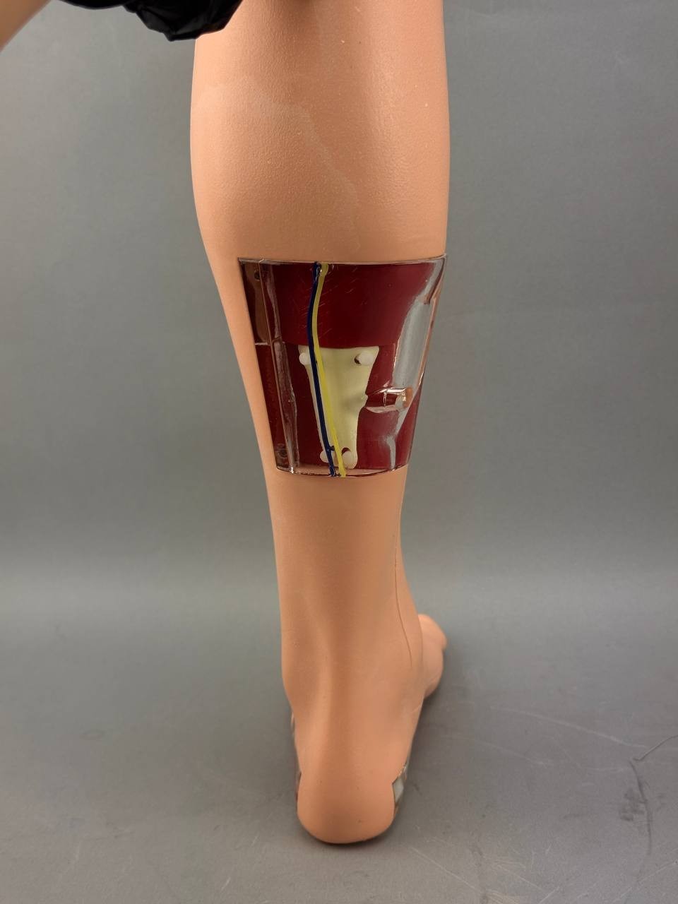 MicroAire Smart Release W/ Leg and Case