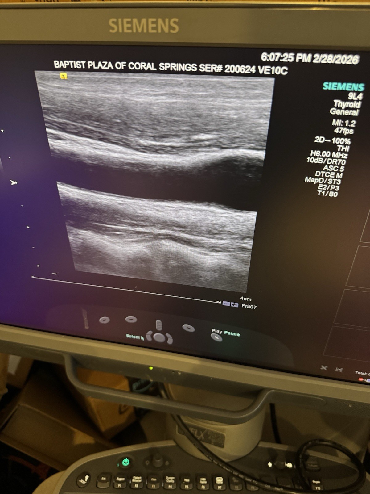 Siemens Acuson 9L4 Multi-D Transducer Probe
