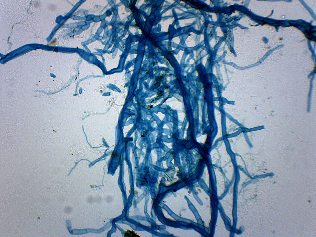 Moss Protonema - WM - Prepared Slide - 75x25mm - Eisco Labs