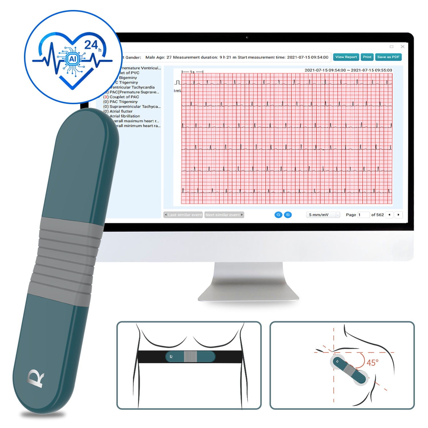 AI Holter Monitor 24 Hrs Chest Strap EKG Monitor with Free AI Analysis PC Report