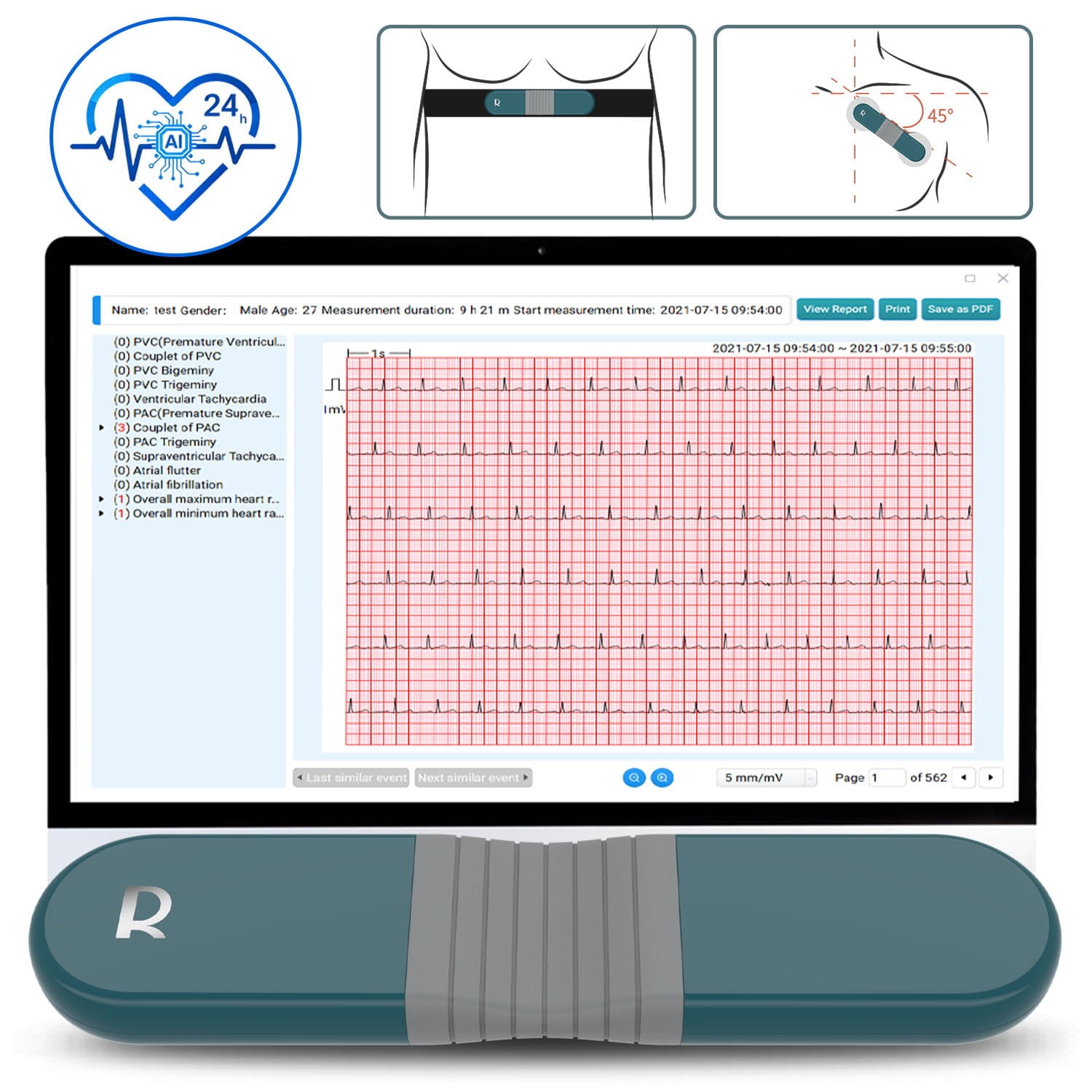 Holter Monitor 24 hours EKG Monitor ECG Recording PC Software Free AI Analysis