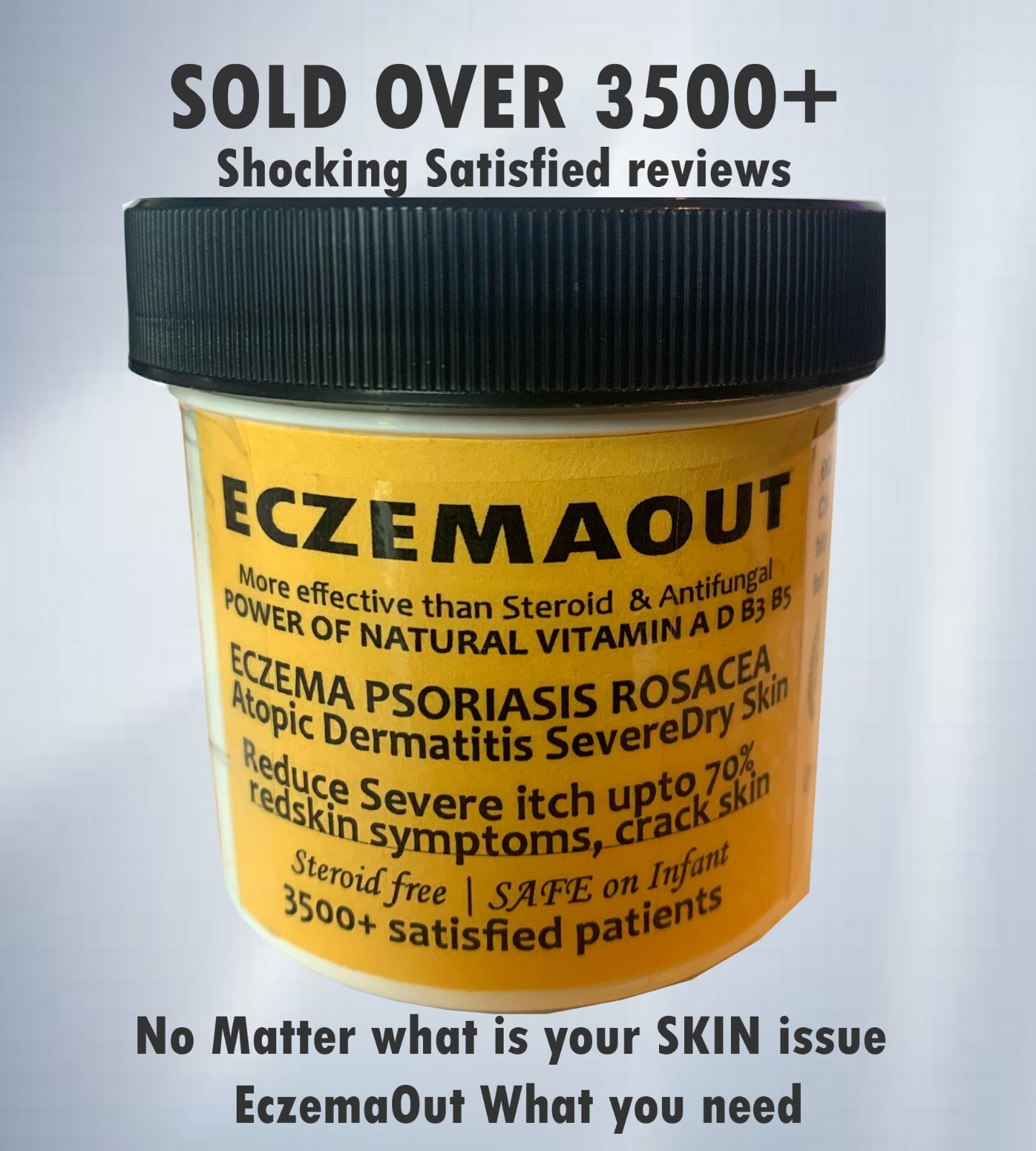 Intense Treatment Cream for Eczema Psoriasis Rosacea Dermatitis Eczemaout Acne