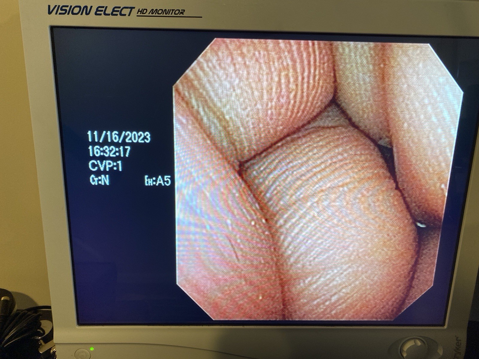 Olympus CYF-V2R Cysto-Nephro Videoscope Endoscope