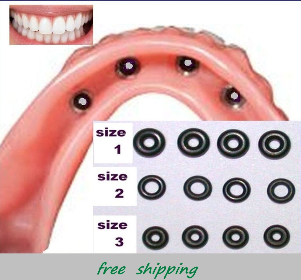 Selection of 3 sizes rubber o-rings replacement for Micro Mini Dental Implants