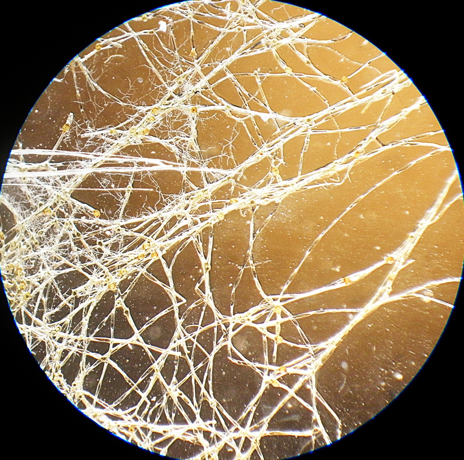 3 Antique Microscope Slides. Freshwater Algaes.