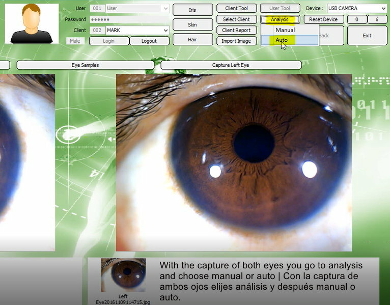 5.0MP USB Iris Analysis Camera Eyes Analyzer Iridology English/Spanish Software