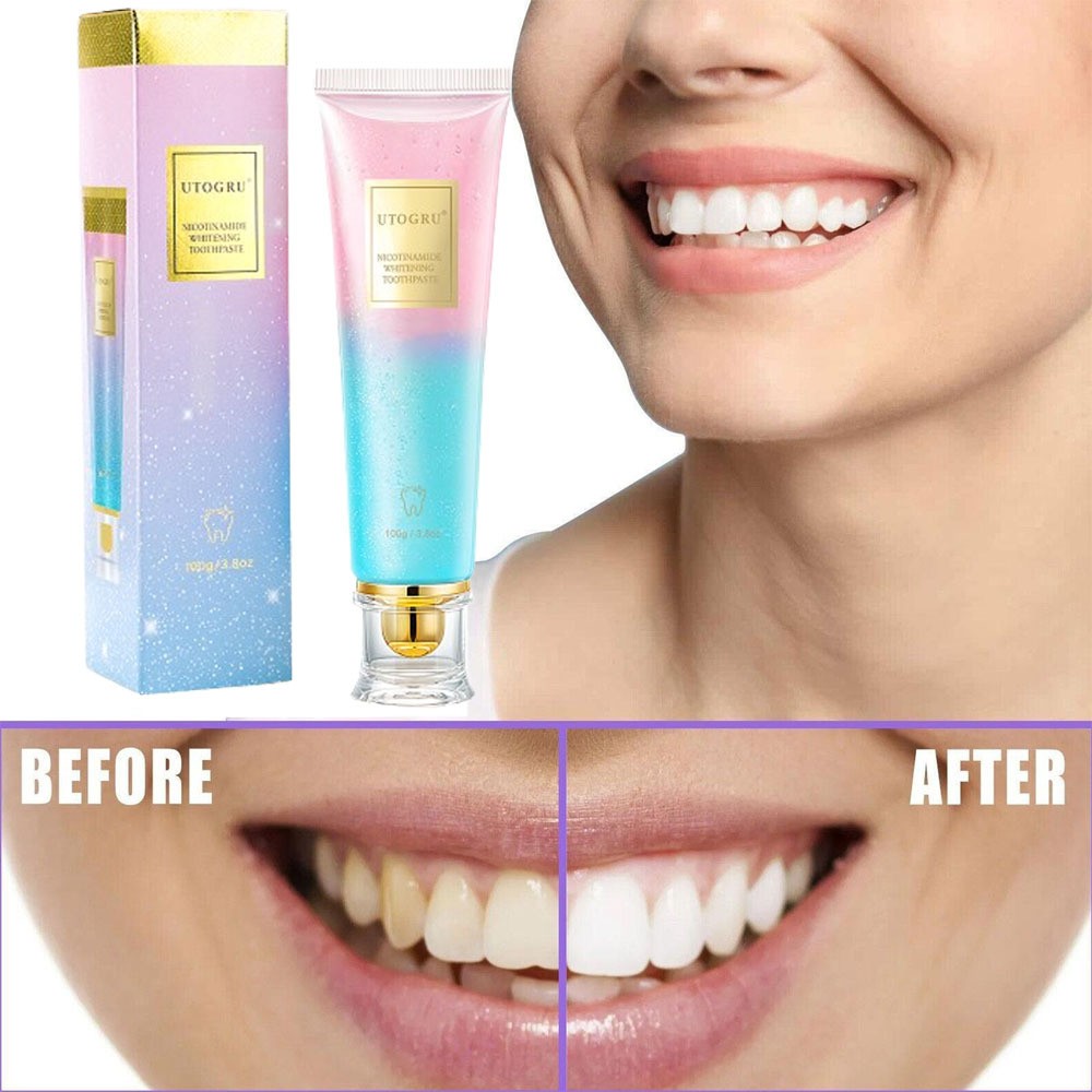 100g Nicotinamide Teeth Whitening Toothpaste Foam Baking Toothpaste Fresh Breath