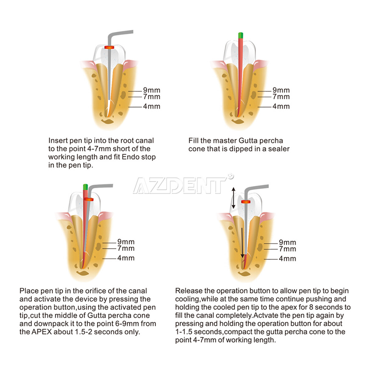 AZDENT Dental Cordless Wireless Gutta Percha Obturation System Endo/Needles Tips