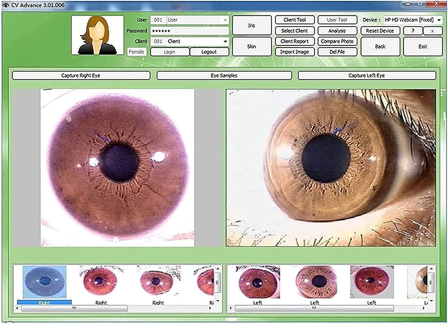 5.0 MP USB Iris Analyzer Iridology Camera with Pro Iris Software Analysis Camera